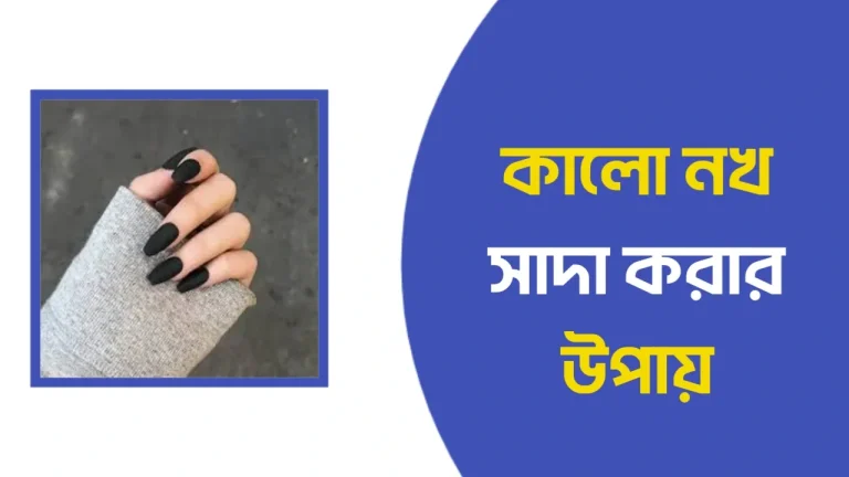 কালো নখ সাদা করার উপায়